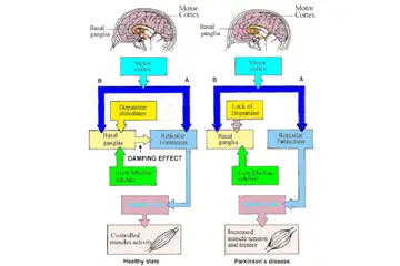 Dopamin Parkinson Belirtileri ve Tedavisi
